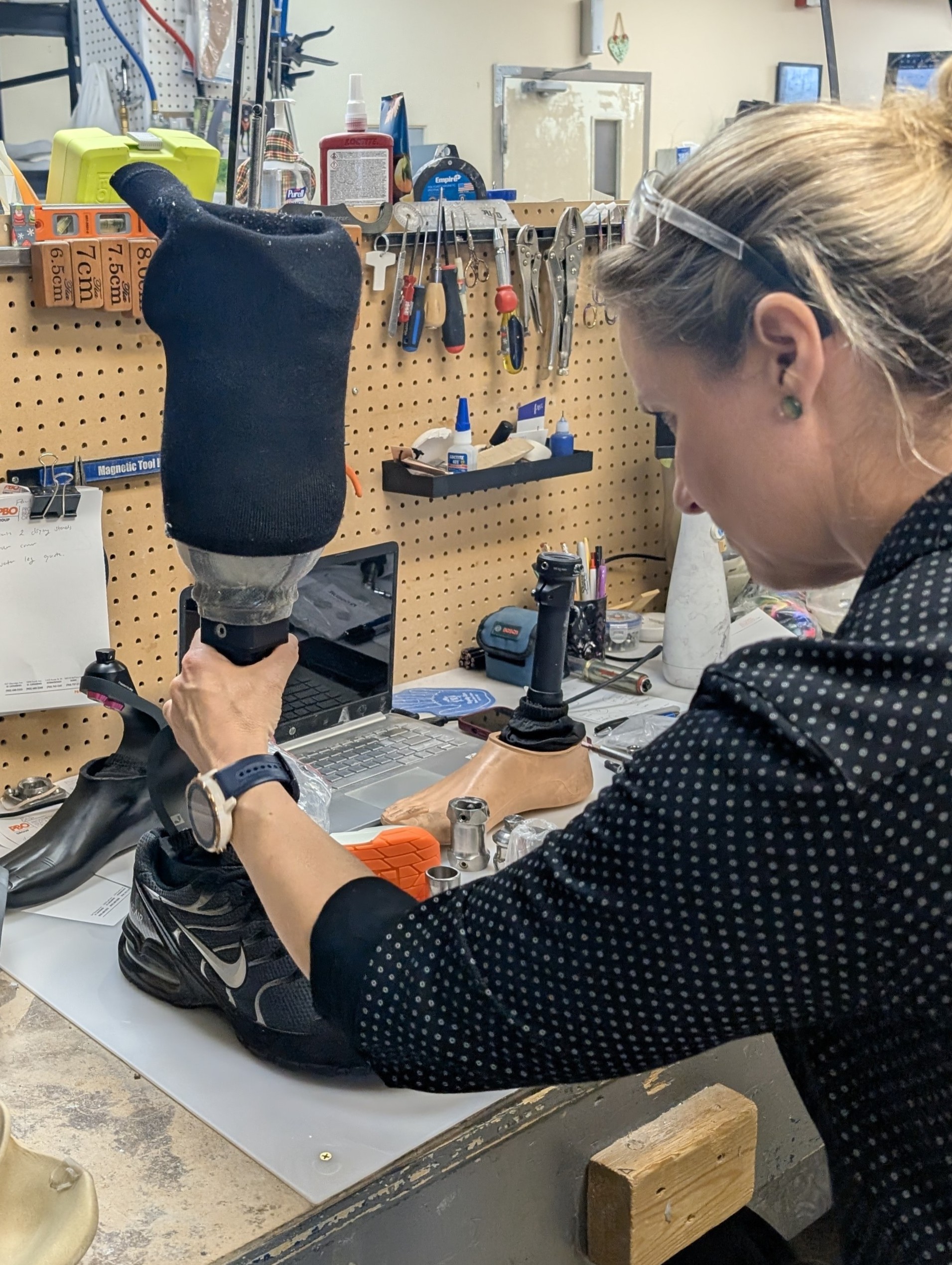 prosthetic-setup
