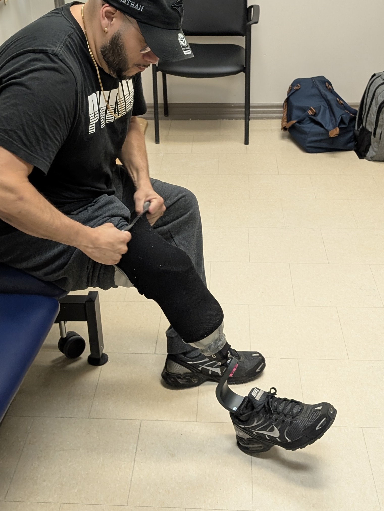 prosthetic-foot-trial