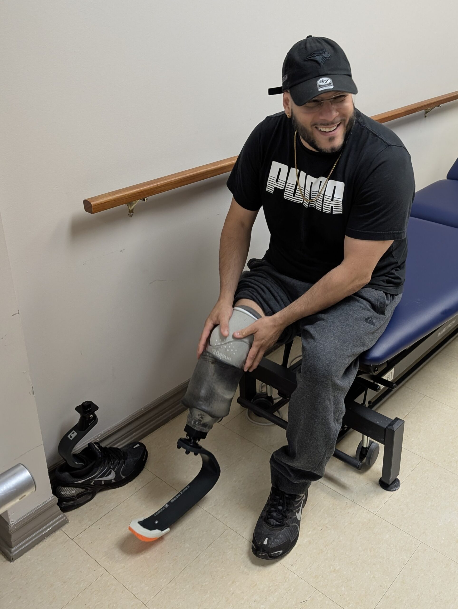 prosthetic-blade-trial