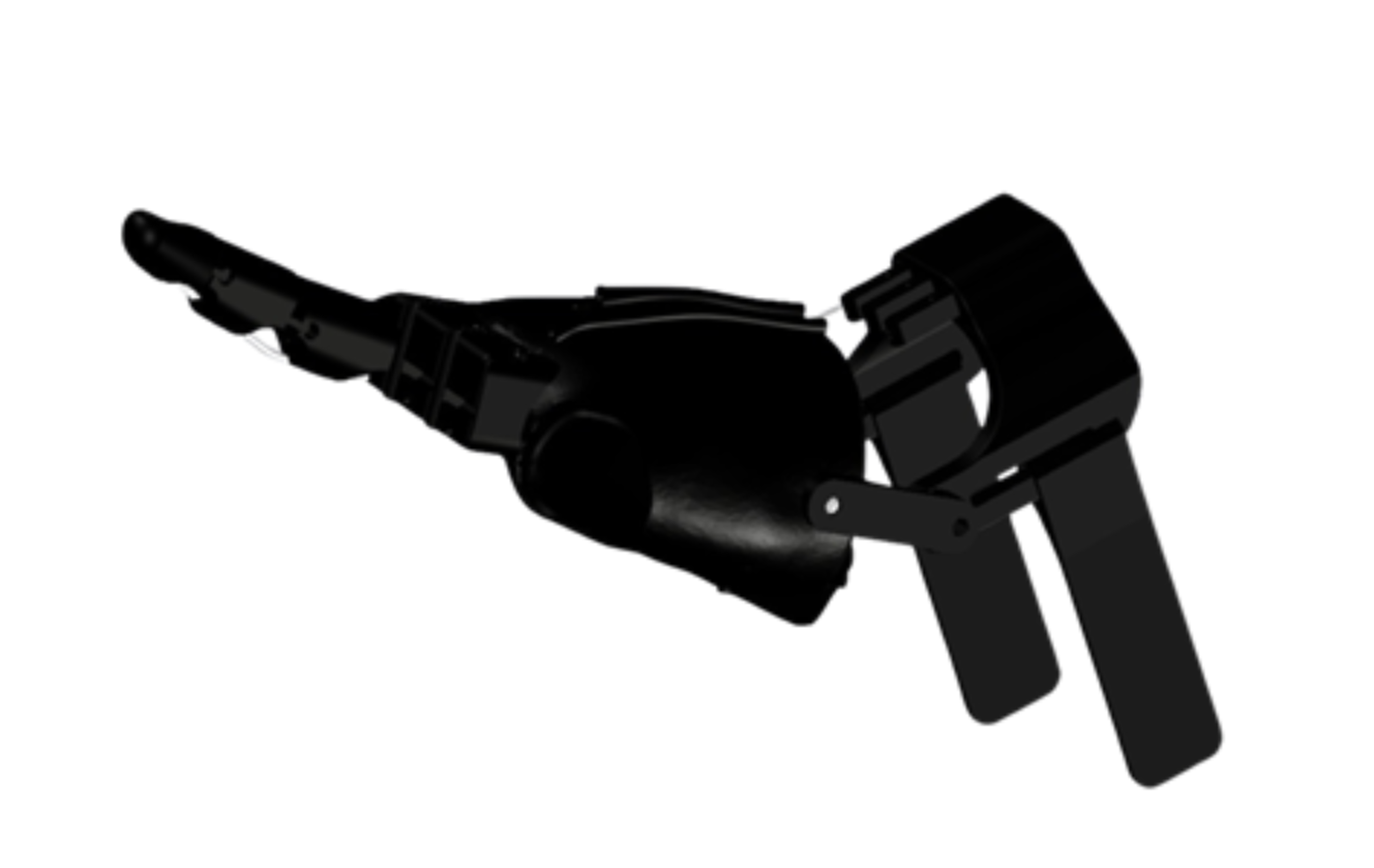 transmetacarpal